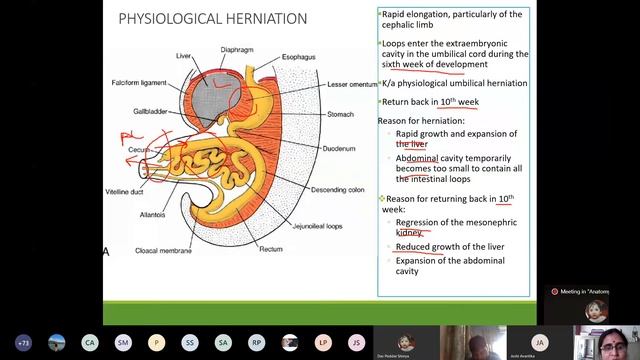Development Of GIT | MBBS Anatomy Lecture смотреть онлайн