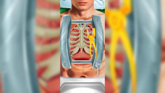 Heart Transplant Surgery -3D Animation смотреть онлайн