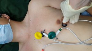 Алгоритм регистрации ЭКГ