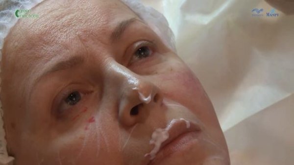 Техника Full Face