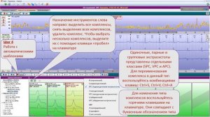 Видеоурок об основных этапах анализа ЭКГ в программе WinIcar