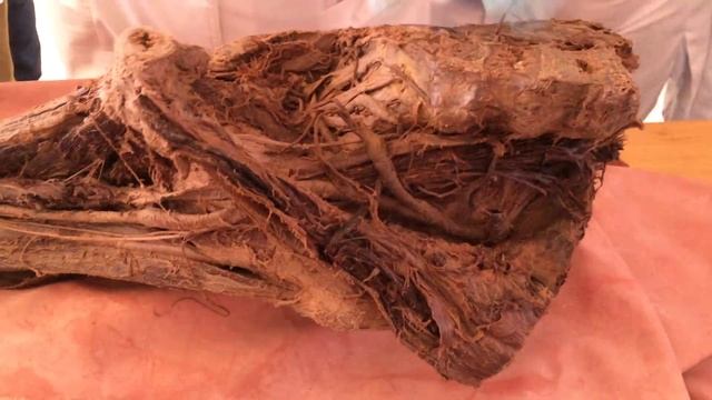 Артерии таза и артерии нижней конечности смотреть онлайн