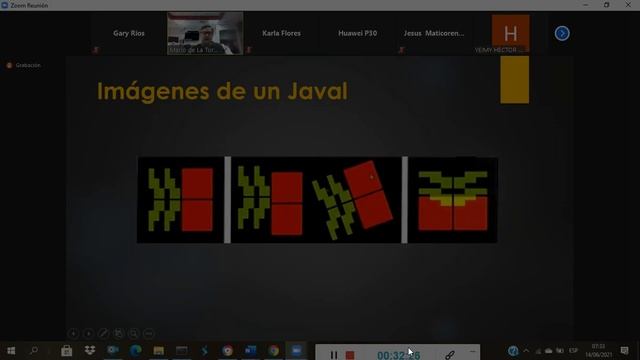 Estudio de imágenes para cirugía de Catarata смотреть онлайн