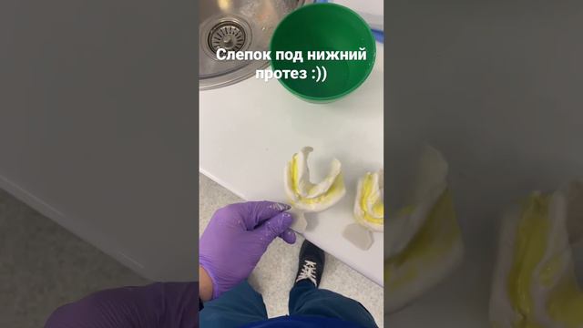 Слепок под полный съемный протез нижняя челюсть, индивидуальная ложка!
