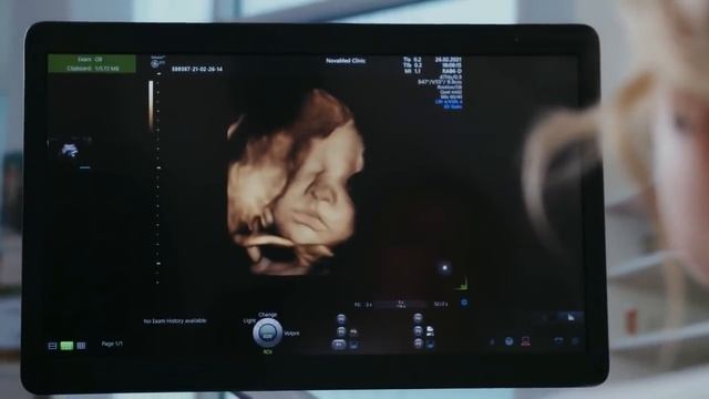 ЧТО ВЫТВОРЯЕТ МАЛЫШ В ЖИВОТЕ ВО ВРЕМЯ УЗИ | 5 интересных вещей которые делает малыш во время УЗИ смотреть онлайн