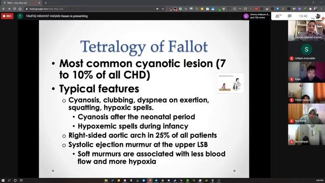 Online Common Lecture (Paediatrics Congenital & Acquired Heart Diseases) by Dr Taufiq смотреть онлайн