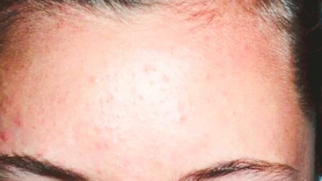 3W Clinic Collagen Whitening Cream Review With Ingredients / Collagen Cream কি স্কিন ফর্সা করে?