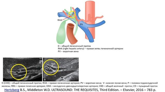 УЗ анатомия ЖП и желчных путей смотреть онлайн