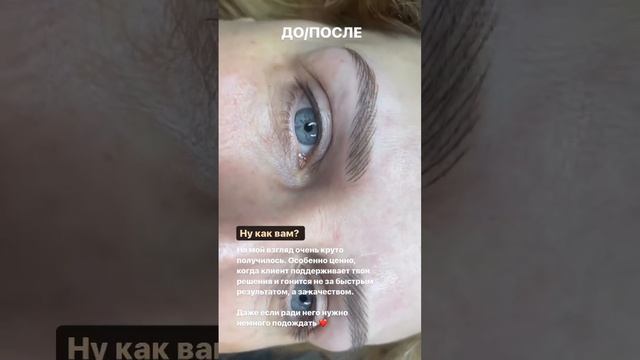 Зажившие стрелки + живые брови после удаления смотреть онлайн
