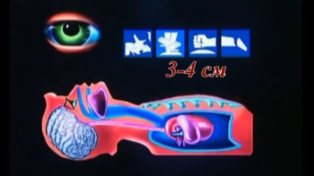 Оказание первой помощи при клинической смерти смотреть онлайн