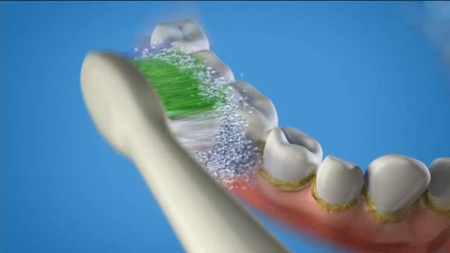Waterpik 5.0 Complete Care System w/ Sonic Toothbrush & Water Flosser on QVC смотреть онлайн