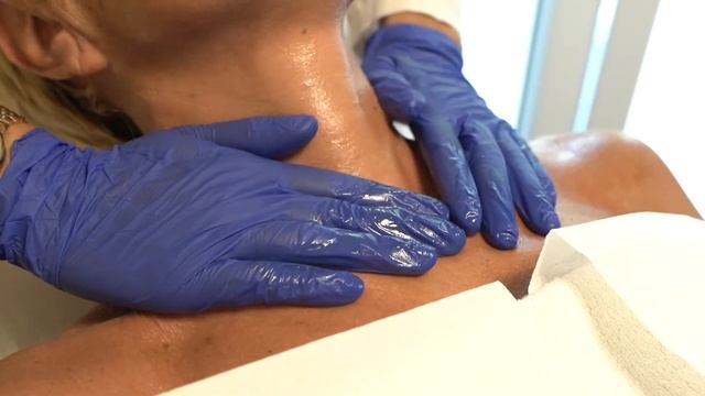 BiorepeelCl3 Kemijski Piling