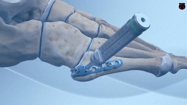 НЕЙМАР НИКУДА НЕ ПЕРЕЙДЕТ. ОН ЗАВЕРШИТ КАРЬЕРУ, ЕГО ПОГУБИЛА ТРАВМА. ВОТ ПОЧЕМУ НЕ ПОКУПАЮТ НЕЙМАРА смотреть онлайн