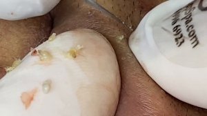 Relax Every Day With Sac Dep Spa #0376