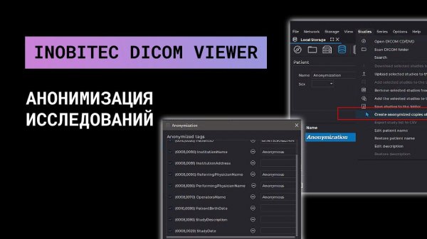 Анонимизация исследований в Инобитек DICOM-Просмотрщике