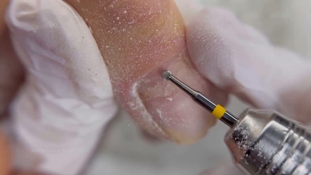 Онихорексис / Трещина на ногте / Ноготь треснул / Что делать / #Nails #Ногти #маникюр смотреть онлайн