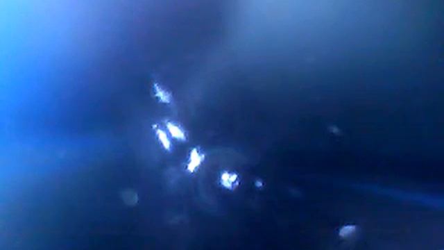 Эндоскоп общий вид смотреть онлайн