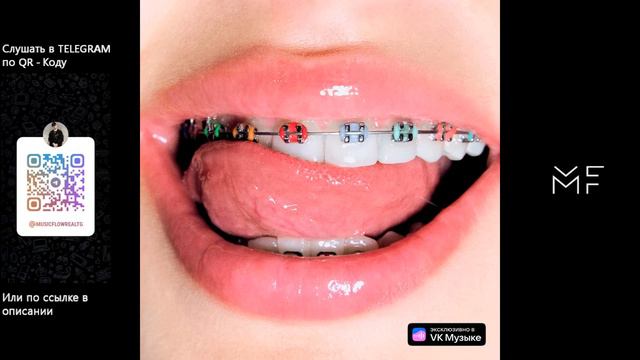 GAVRILINA - Брекеты смотреть онлайн