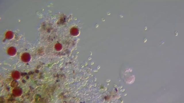 The Amazing Microscopic Monster World Bacterias 1000x 10000x microscopic PART 2 смотреть онлайн