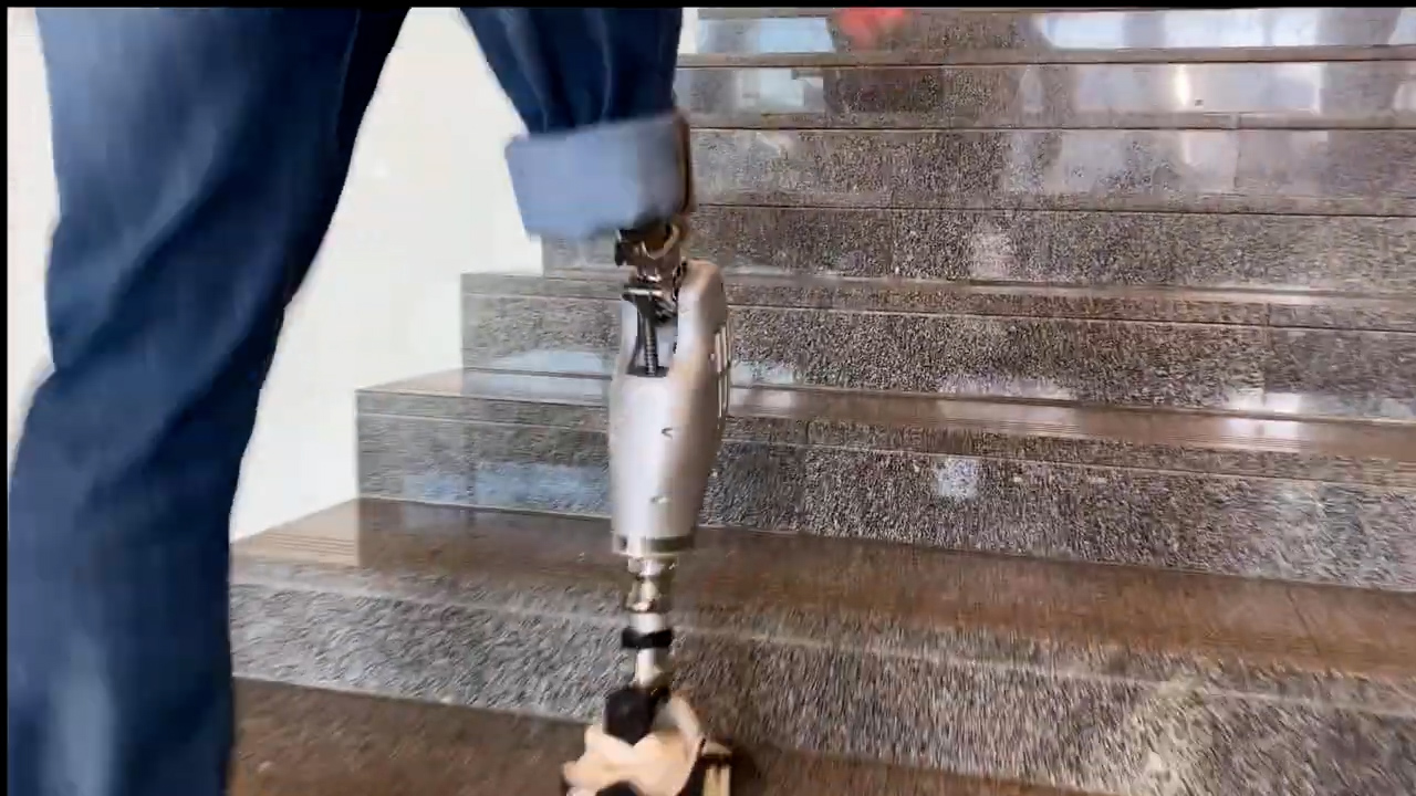 Тесла в мире протезов! Протез, который идет сам! Миф? смотреть онлайн