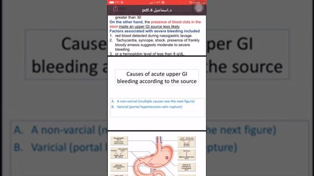 Upper GIT bleeding 1 باطنية شرح عمر خلف смотреть онлайн