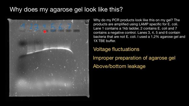 What caused such gel electrophoresis - explained смотреть онлайн