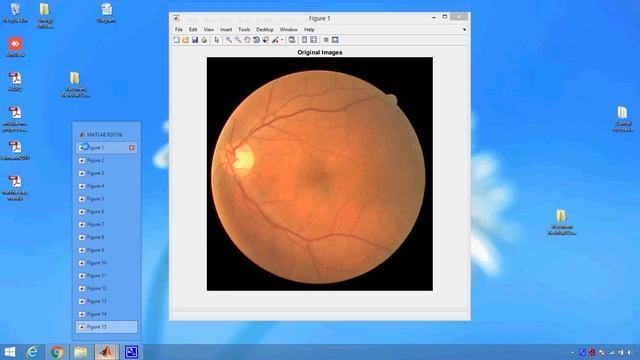 Recurrent Residual Convolutional Neural Network based on U Net R2U Net for Medical Image Segmentati смотреть онлайн