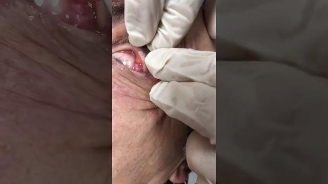 Работа с глазами смотреть онлайн