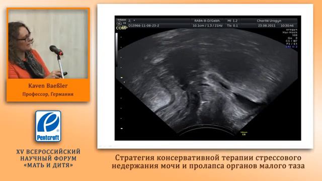 Стратегия консервативных подходов к лечению пролапса гениталий проф. Caven Bassler Берлин Г смотреть онлайн
