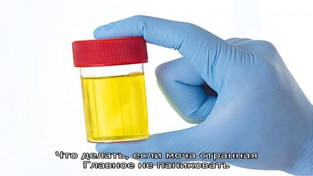 Пленка на поверхности мочи