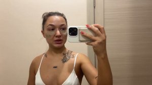 ЭТАПЫ ВОССТАНОВЛЕНИЯ ПОСЛЕ БЛЕФАРОПЛАСТИКИ ПО ДНЯМ. РЕЗУЛЬТАТ!