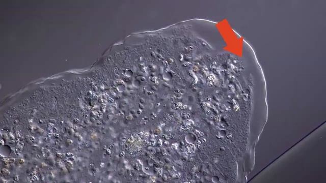 Наглядная микробиология #3 Амёба (Amoeba)