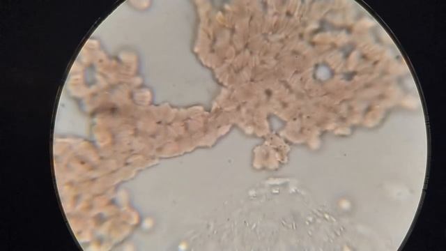 Кровь после сухого голодания смотреть онлайн