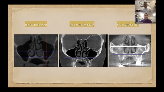 Конституционально-ориентированная стоматология. Часть №5