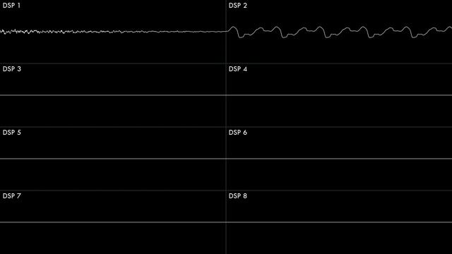 Sand Canyon 3 [Kirby's Dream Land 3] | Oscilloscope + Deconstruction смотреть онлайн