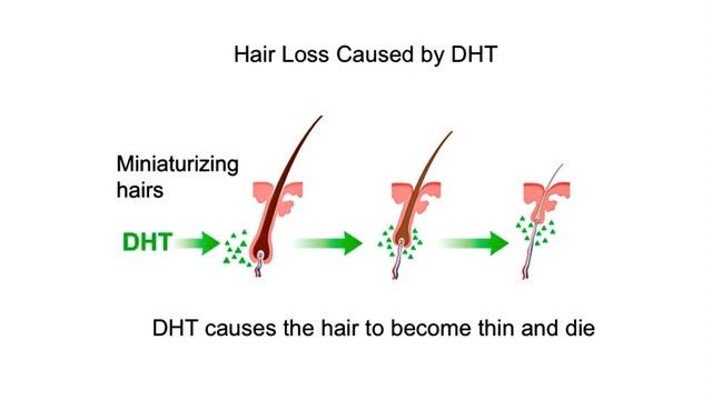 Limitations, Ineffectiveness of PRP, Mesotherapy Hair Loss Treatments, and a Better Alternative смотреть онлайн