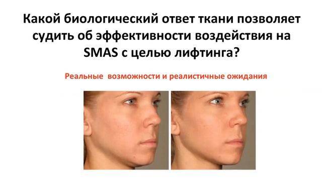 ОСНОВЫ ТЕХНОЛОГИИ HIFUS смотреть онлайн