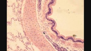 ЛЕГКОЕ  LUNG  гистологическое строение