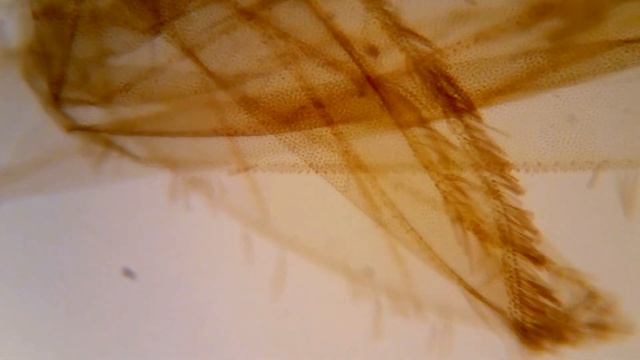Комар под микроскопом (Mosquito under a microscope) смотреть онлайн