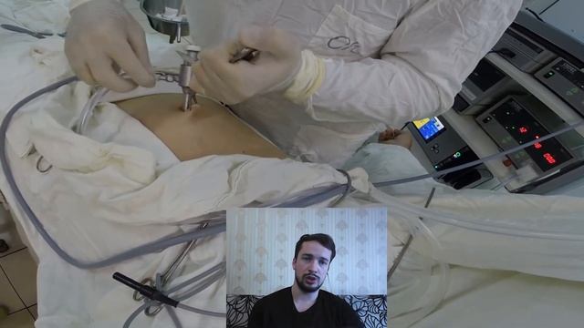 Лапароскопия. Этап постановки лапароскопического порта. смотреть онлайн