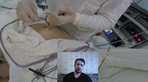 Лапароскопия. Этап постановки лапароскопического порта.