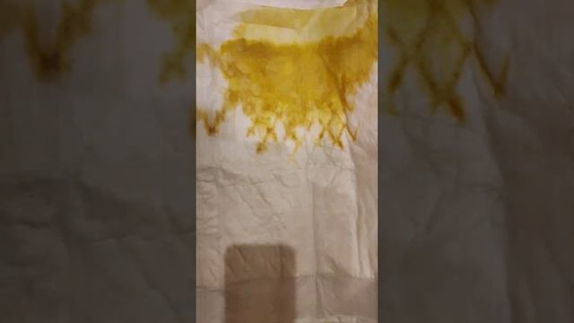 Видео только для тех,у кого маленькие собачки и ходят на пелёнку.Я медик. смотреть онлайн