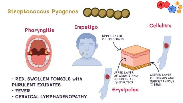 Gram Positive Bacteria: Streptococcus Pyogenes смотреть онлайн