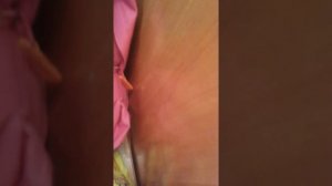 Санаторий ,,МВД г. Железноводск» хататур