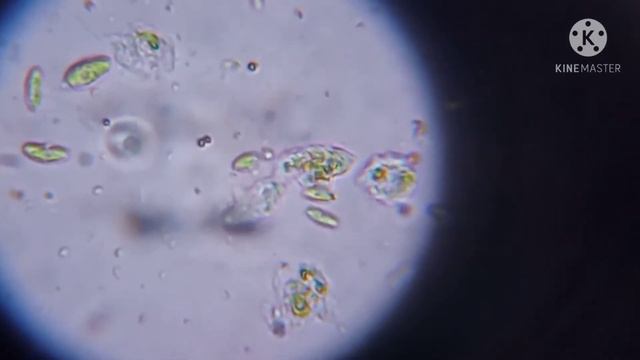 ВОДНЫЕ БАКТЕРИИ ПОД МИКРОСКОПОМ смотреть онлайн