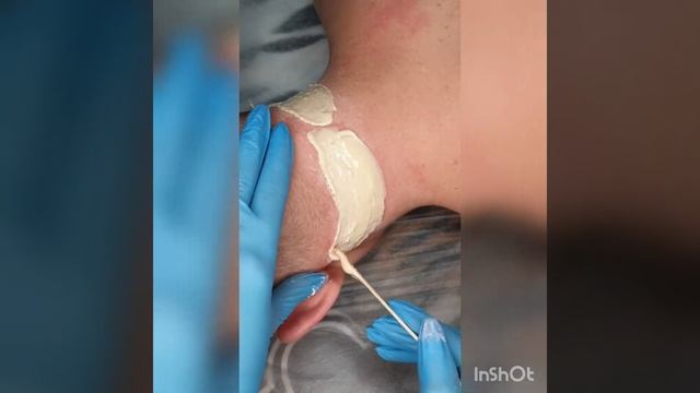 Мужская эпиляция. смотреть онлайн