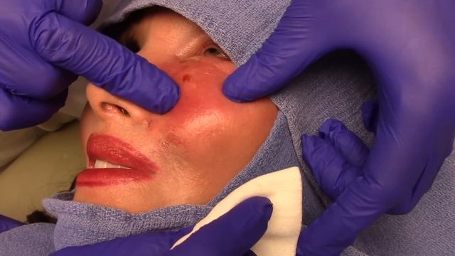 Filler Gone Bad | Dr. Derm смотреть онлайн