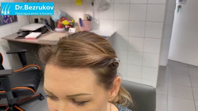 Пересадка волос в Алматы. Клиника Dr.Bezrukova. смотреть онлайн