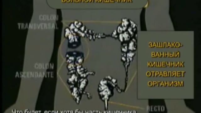 Кишечник+очищение= ЗДОРОВЬЯ! КОЛОВАДА + смотреть онлайн
