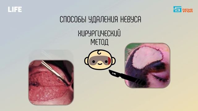 Лечение американской девочки в России | Комментарии иностранцев смотреть онлайн